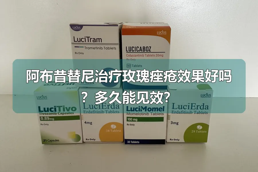 阿布昔替尼治疗玫瑰痤疮效果好吗？多久能见效？
