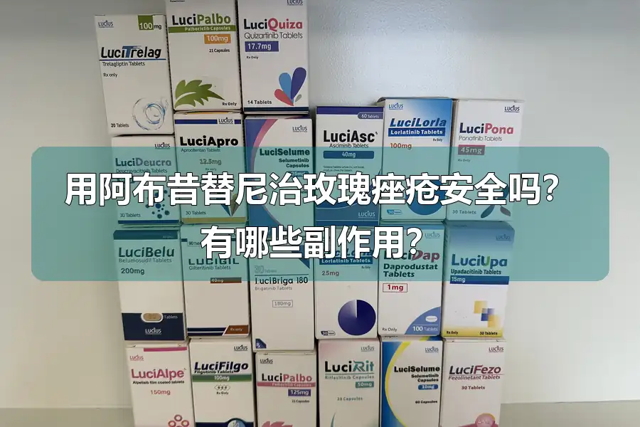 用阿布昔替尼治玫瑰痤疮安全吗？有哪些副作用？